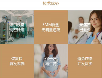 子宫肌瘤的常见病因